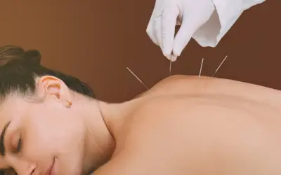 Acupuncture for Lower Back Pain: An Ancient Solution to Modern Problems